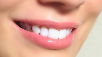 Obnova zubne cakline