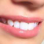 Obnova zubne cakline